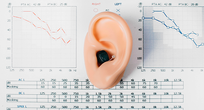 귀 모형과 보청기